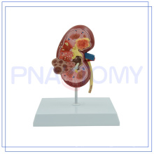 PNT-0739 China fabricante modelo de sección de riñón humano con el mejor precio